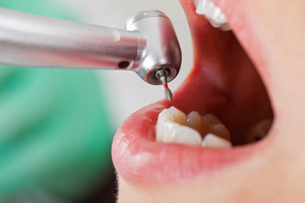 Tooth Infection Emergency Dentist in WV